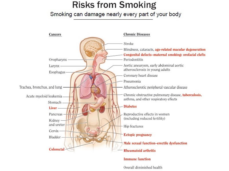 Compassionate-Care-at-Durdans-Hospital-for-Health-Conditions-Caused-by-Tobacco-Use.jpg